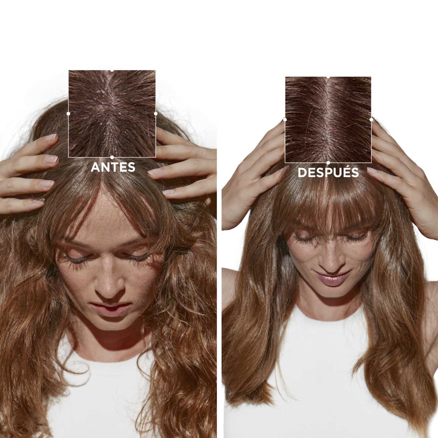 kerastase_antesydespues
